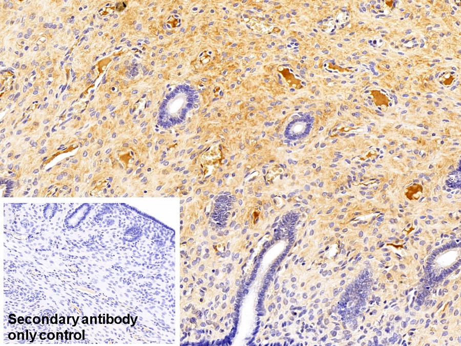 Monoclonal Antibody to Immunoglobulin G (IgG)