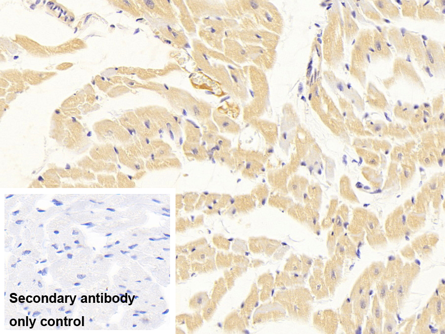 Monoclonal Antibody to Immunoglobulin G (IgG)