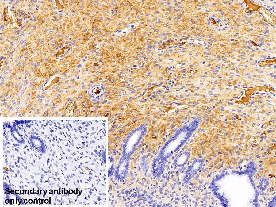 Monoclonal Antibody to Immunoglobulin G (IgG)