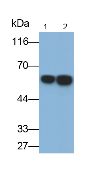 Monoclonal Antibody to Immunoglobulin E (IgE)