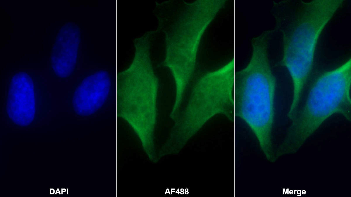 Monoclonal Antibody to Vascular Cell Adhesion Molecule 1 (VCAM1)