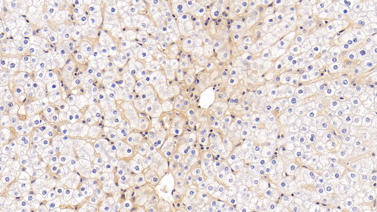 Monoclonal Antibody to Intercellular Adhesion Molecule 1 (ICAM1)