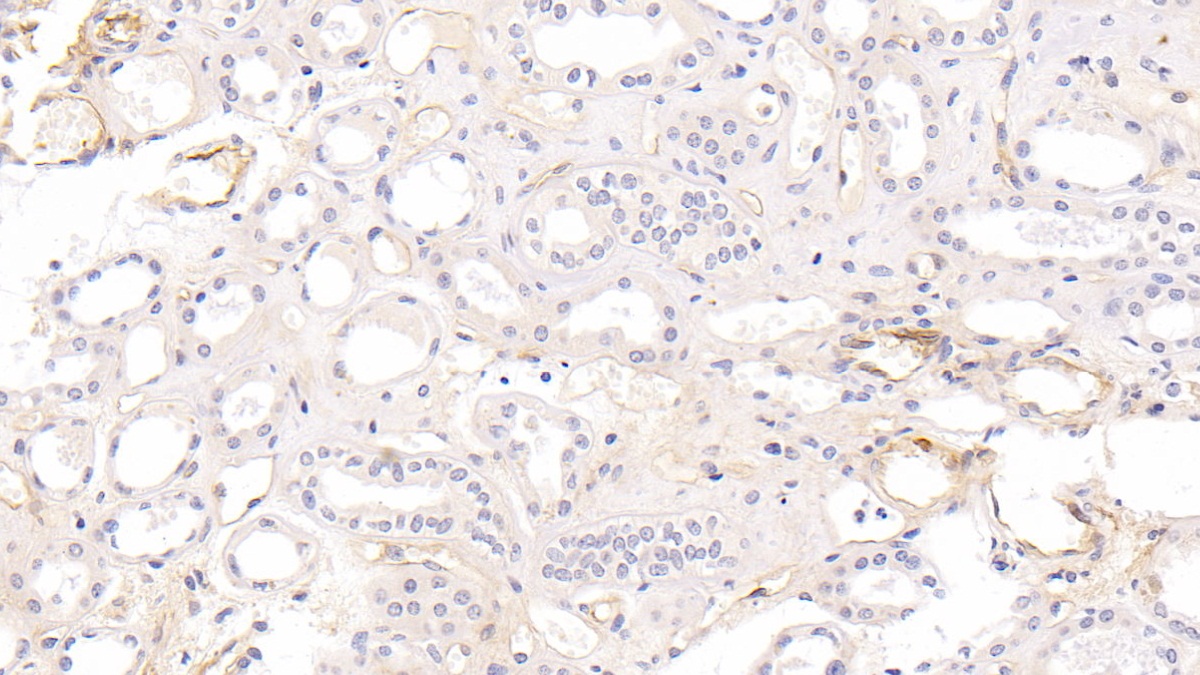 Monoclonal Antibody to Intercellular Adhesion Molecule 1 (ICAM1)