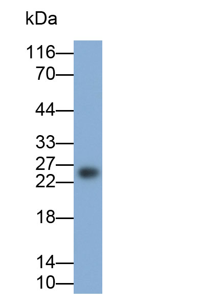 Monoclonal Antibody to Tissue Inhibitors Of Metalloproteinase 1 (TIMP1)