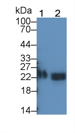 Monoclonal Antibody to Tissue Inhibitors Of Metalloproteinase 1 (TIMP1)