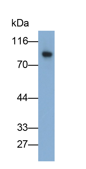 Monoclonal Antibody to Matrix Metalloproteinase 9 (MMP9)