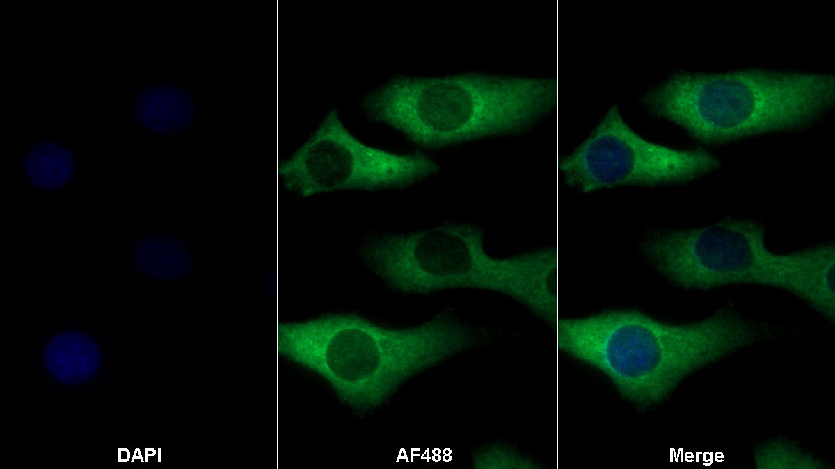 Monoclonal Antibody to Matrix Metalloproteinase 9 (MMP9)