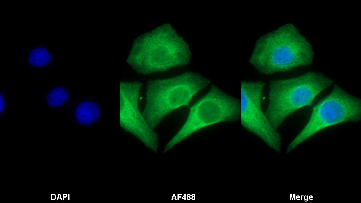 Monoclonal Antibody to Matrix Metalloproteinase 9 (MMP9)