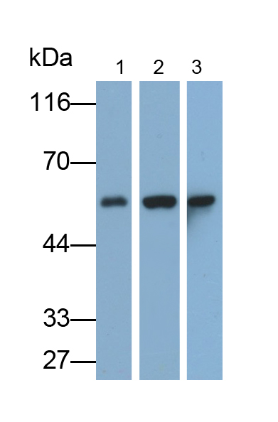 Monoclonal Antibody to Cytokeratin 7 (CK7)