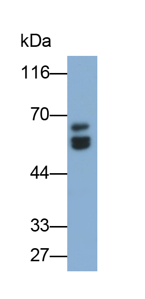 Monoclonal Antibody to Cytokeratin 7 (CK7)