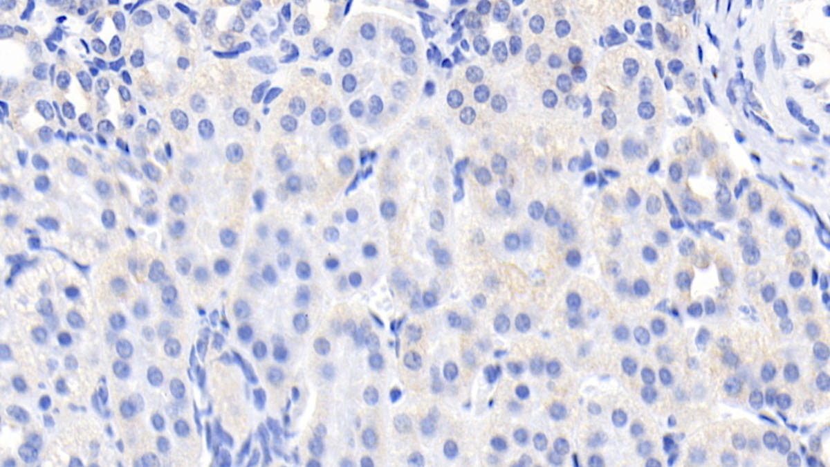 Monoclonal Antibody to Epidermal Growth Factor (EGF)