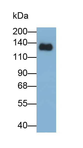 Monoclonal Antibody to Epidermal Growth Factor (EGF)