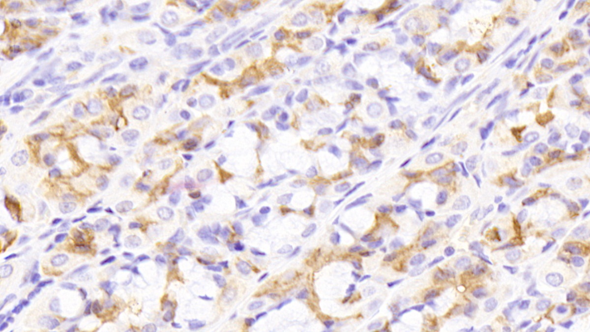 Monoclonal Antibody to Epidermal Growth Factor (EGF)