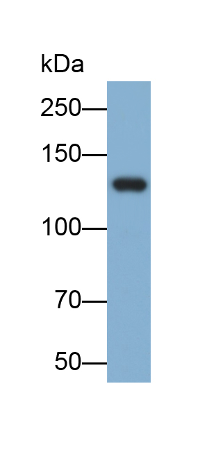 Monoclonal Antibody to Epidermal Growth Factor (EGF)