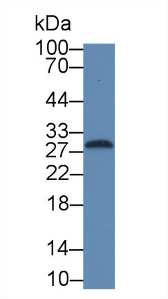 Monoclonal Antibody to Interleukin 1 Beta (IL1b)