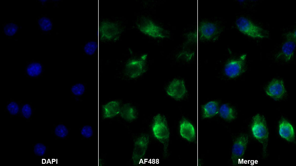 Monoclonal Antibody to Interleukin 1 Beta (IL1b)