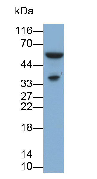 Monoclonal Antibody to Interleukin 1 Beta (IL1b)