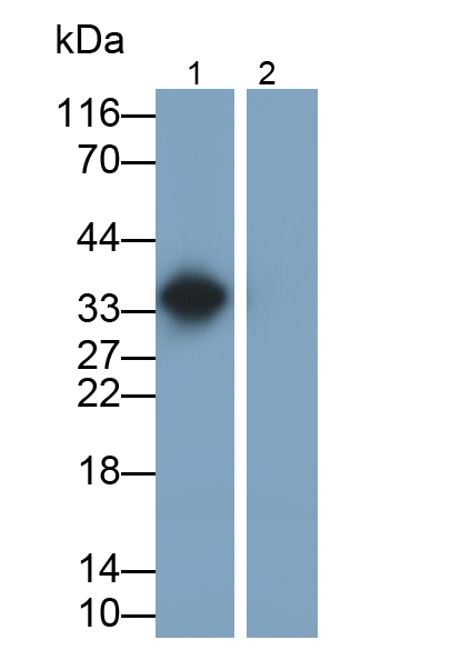 Monoclonal Antibody to Interleukin 1 Beta (IL1b)