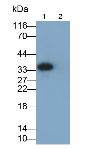 Monoclonal Antibody to Interleukin 1 Beta (IL1b)