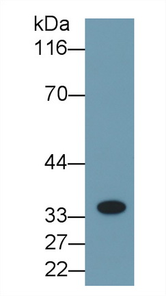 Monoclonal Antibody to Interleukin 1 Beta (IL1b)