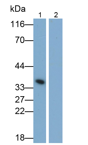 Monoclonal Antibody to Interleukin 1 Beta (IL1b)