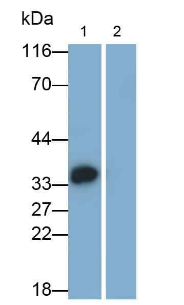 Monoclonal Antibody to Interleukin 1 Beta (IL1b)