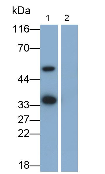 Monoclonal Antibody to Interleukin 1 Beta (IL1b)