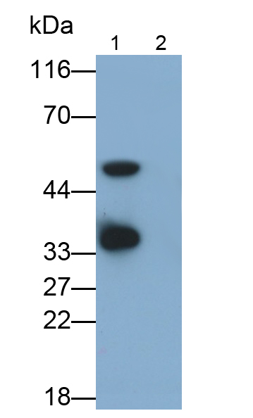 Monoclonal Antibody to Interleukin 1 Beta (IL1b)