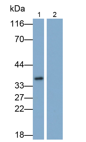 Monoclonal Antibody to Interleukin 1 Beta (IL1b)