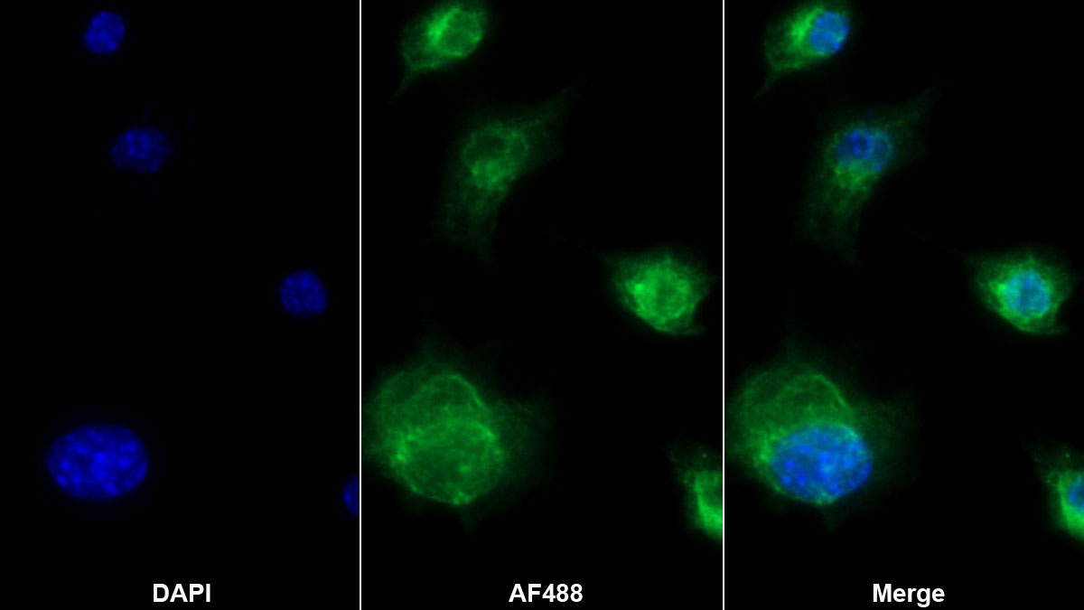 Monoclonal Antibody to Interleukin 1 Beta (IL1b)