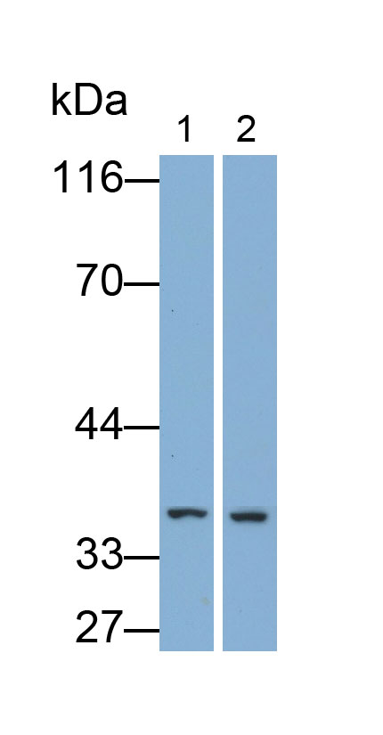 Monoclonal Antibody to Interleukin 1 Beta (IL1b)