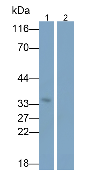 Monoclonal Antibody to Interleukin 1 Beta (IL1b)