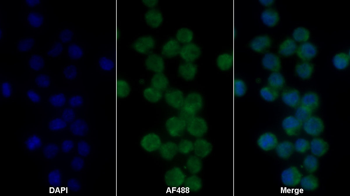 Monoclonal Antibody to Interleukin 1 Beta (IL1b)