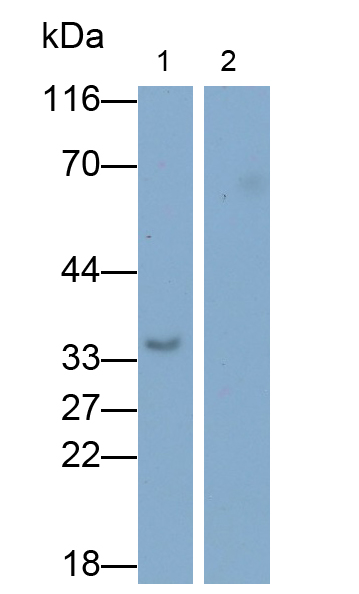 Monoclonal Antibody to Interleukin 1 Beta (IL1b)