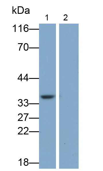 Monoclonal Antibody to Interleukin 1 Beta (IL1b)