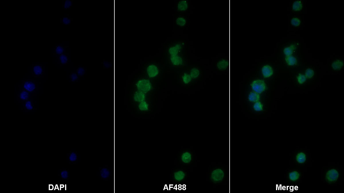 Monoclonal Antibody to Interleukin 1 Beta (IL1b)