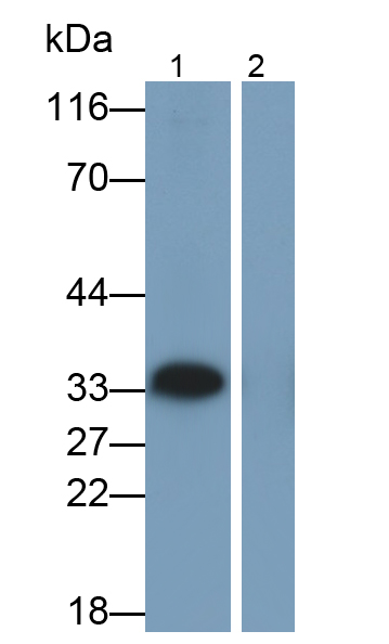 Monoclonal Antibody to Interleukin 1 Beta (IL1b)