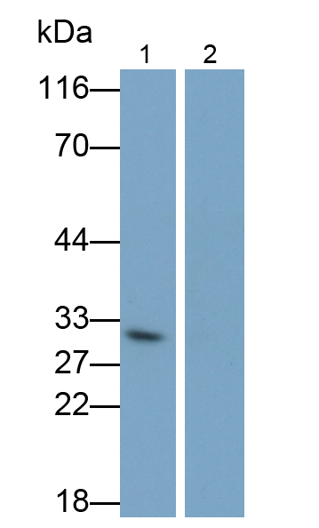 Monoclonal Antibody to Interleukin 1 Beta (IL1b)