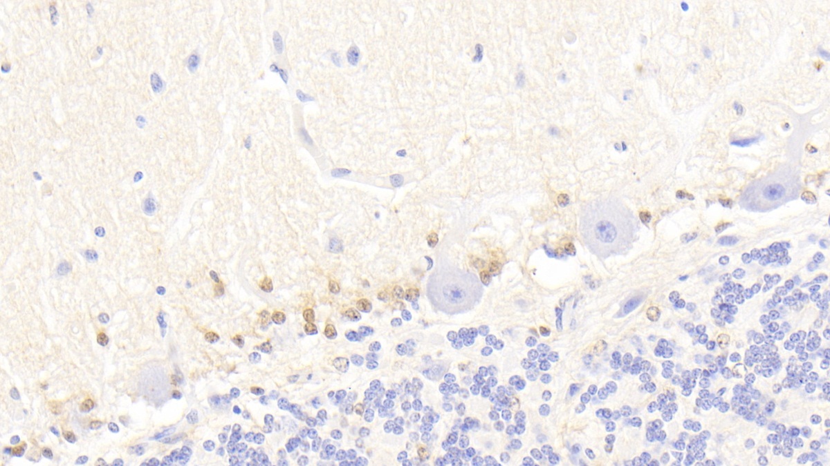 Monoclonal Antibody to S100 Calcium Binding Protein B (S100B)