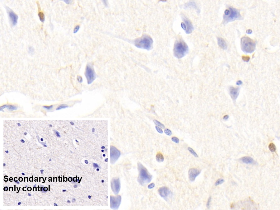 Monoclonal Antibody to S100 Calcium Binding Protein B (S100B)