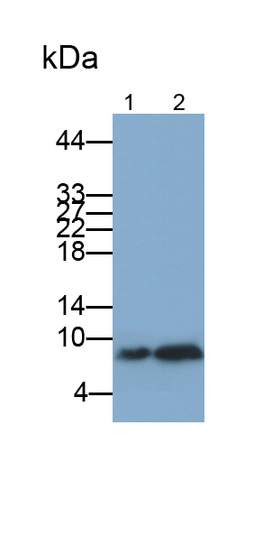 Monoclonal Antibody to S100 Calcium Binding Protein B (S100B)