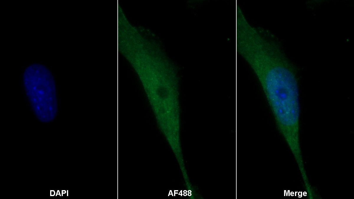 Monoclonal Antibody to S100 Calcium Binding Protein A11 (S100A11)