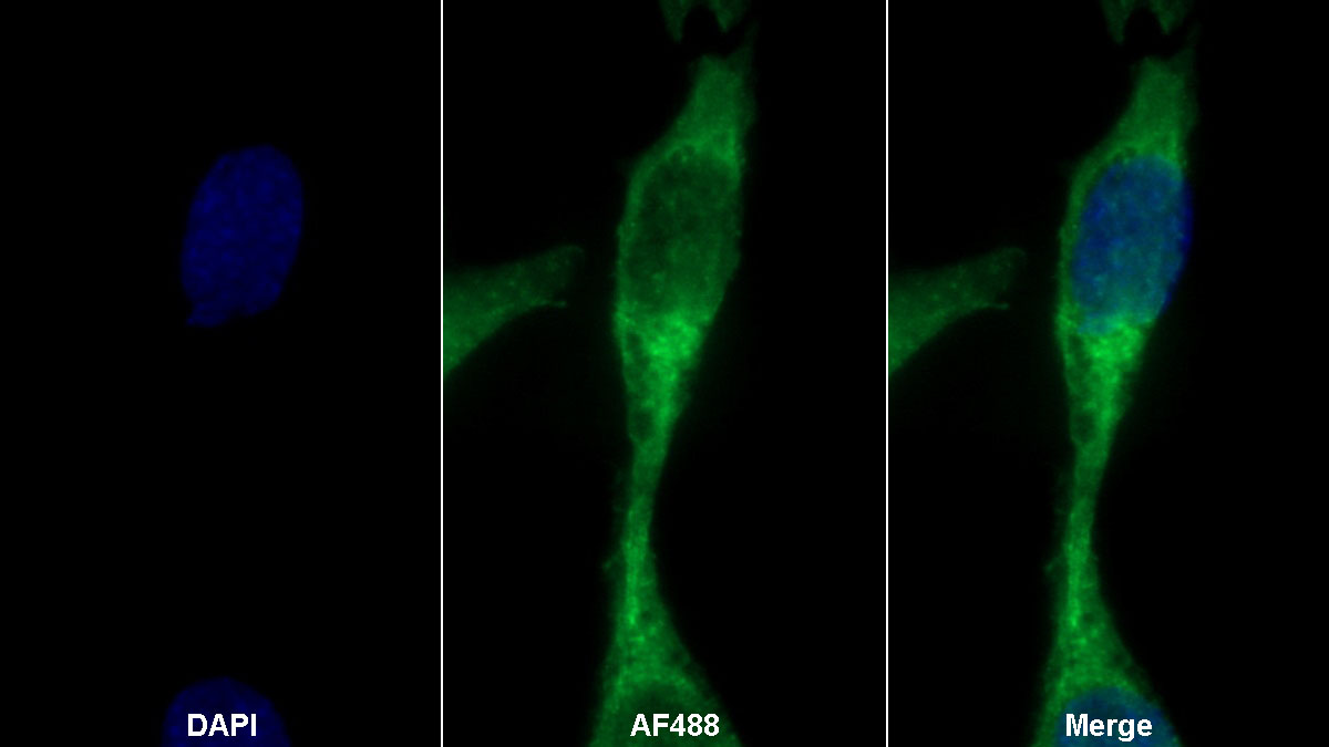 Monoclonal Antibody to S100 Calcium Binding Protein A11 (S100A11)