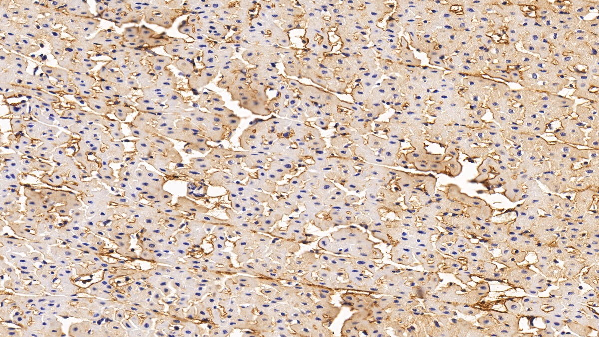 Monoclonal Antibody to Procollagen III N-Terminal Propeptide (PIIINP)