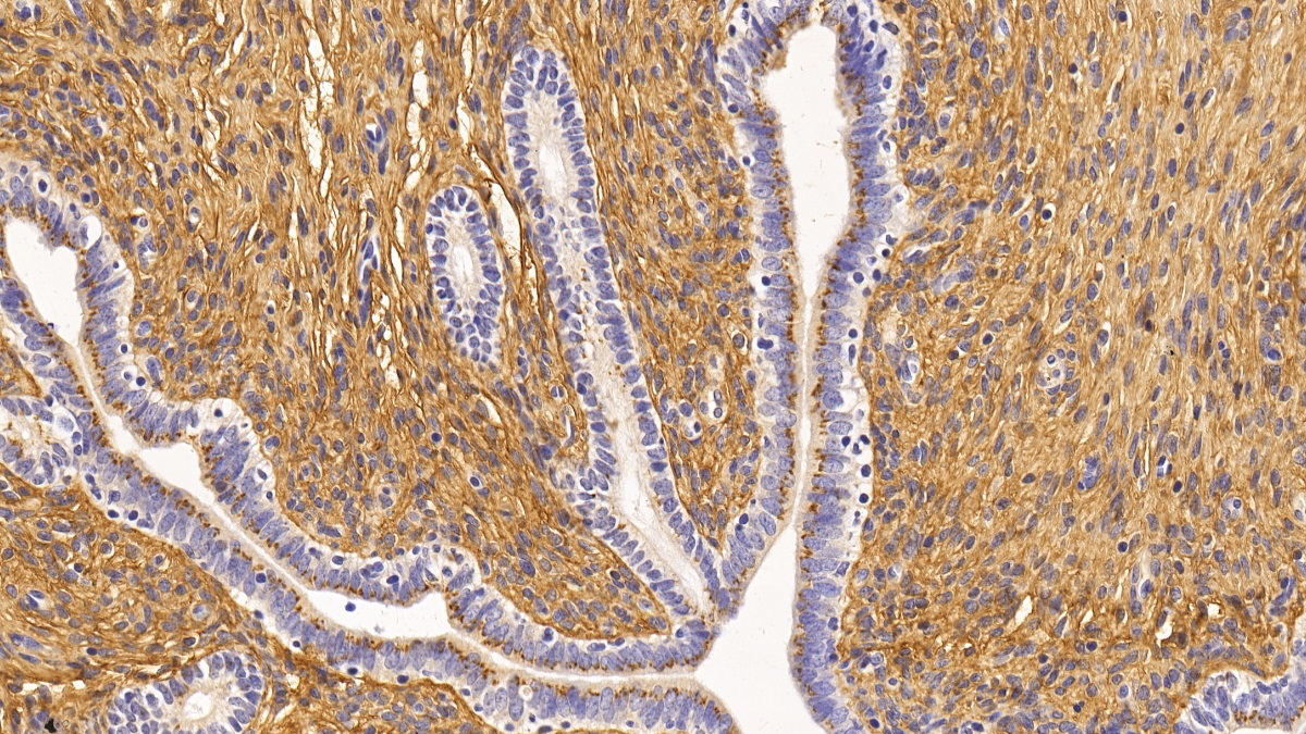 Monoclonal Antibody to Procollagen III N-Terminal Propeptide (PIIINP)