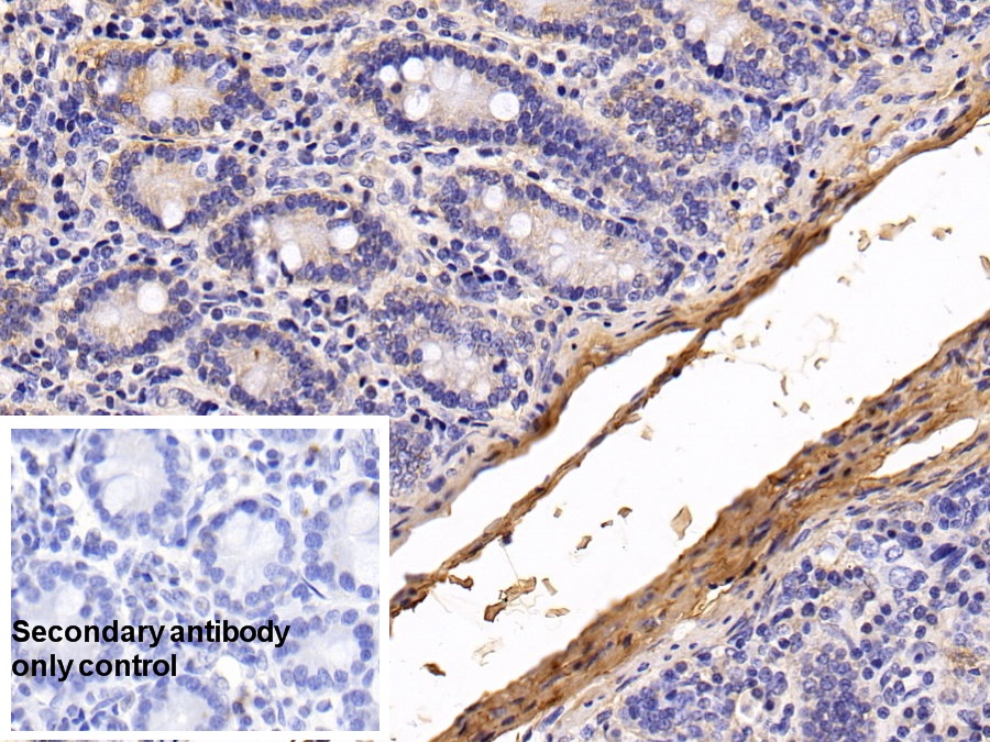 Monoclonal Antibody to Procollagen III N-Terminal Propeptide (PIIINP)