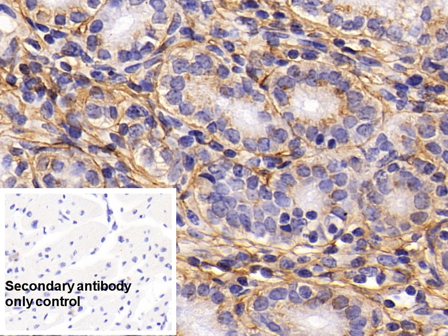 Monoclonal Antibody to Procollagen III N-Terminal Propeptide (PIIINP)