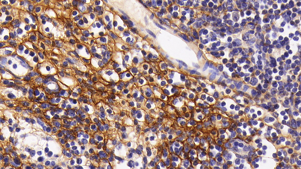 Monoclonal Antibody to Procollagen III N-Terminal Propeptide (PIIINP)