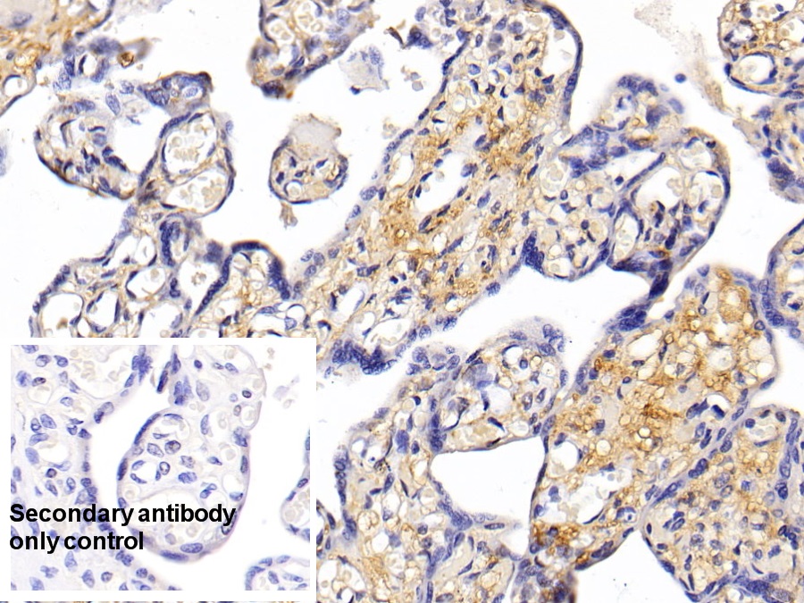 Monoclonal Antibody to Procollagen III N-Terminal Propeptide (PIIINP)