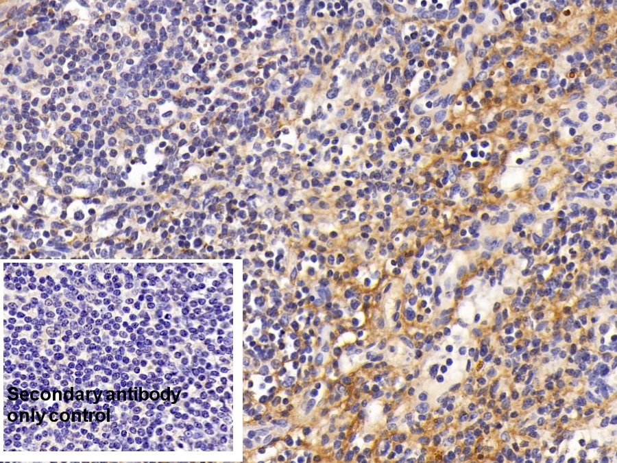 Monoclonal Antibody to Procollagen III N-Terminal Propeptide (PIIINP)